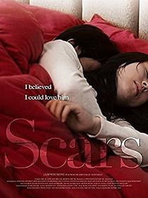Watch Scars