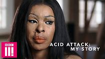 Watch Acid Attack: My Story