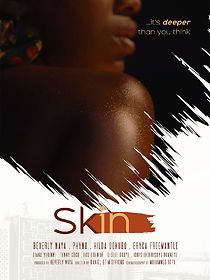 Watch Skin