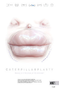 Watch Caterpillarplasty