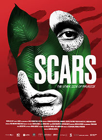 Watch Scars