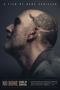 Watch No Bone: Scars of Survival