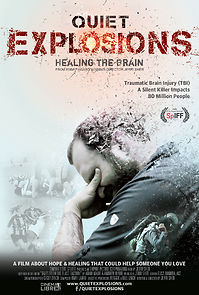 Watch Quiet Explosions: Healing the Brain