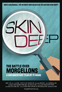 Watch Skin Deep: The Battle Over Morgellons