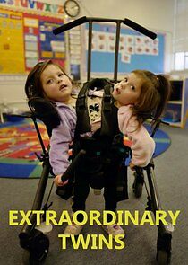 Watch Extraordinary Twins
