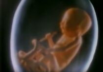 Watch The American Cancer Society: Smoking Fetus
