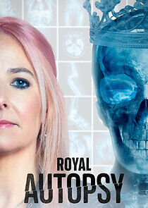 Watch Royal Autopsy