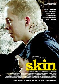 Watch Skin