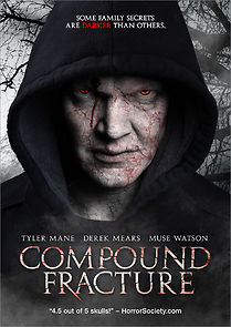 Watch Compound Fracture