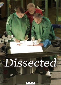 Watch Dissected