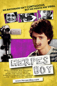 Watch Herpes Boy