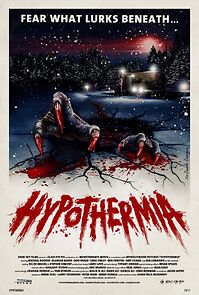 Watch Hypothermia