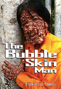Watch The Bubble Skin Man