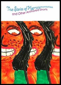 Watch True Stories of Hyperpigmentation (Short 2009)