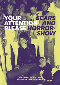 Watch Your Attention Please: Scars