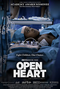 Watch Open Heart