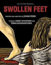 Watch Swollen Feet