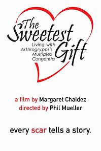 Watch The Sweetest Gift: Living with Arthrogryposis Multiplex Congenita