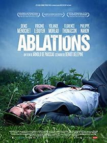 Watch Ablations