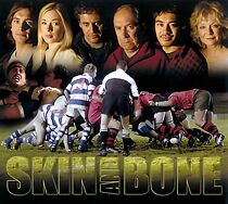 Watch Skin & Bone