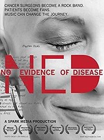 Watch No Evidence of Disease