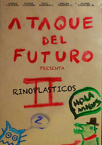 Watch Rinoplasticos II