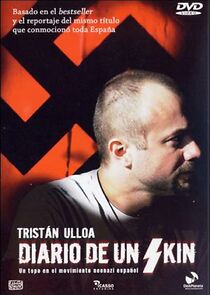 Watch Diario de un skin